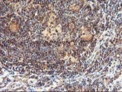 Immunohistochemistry: LCMT1 Antibody (OTI2C9) - Azide and BSA Free [NBP2-71927] - Staining of paraffin-embedded Human lymphoma tissue using anti-LCMT1 mouse monoclonal antibody.