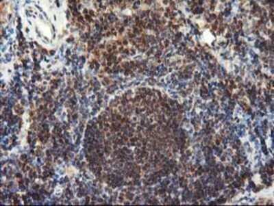 Immunohistochemistry: LCMT1 Antibody (OTI2C9) - Azide and BSA Free [NBP2-71927] - Staining of paraffin-embedded Human tonsil using anti-LCMT1 mouse monoclonal antibody.