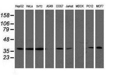 Western Blot: LCMT1 Antibody (OTI2C9) - Azide and BSA Free [NBP2-71927] - Analysis of extracts (35ug) from 9 different cell lines by using anti-LCMT1 monoclonal antibody.