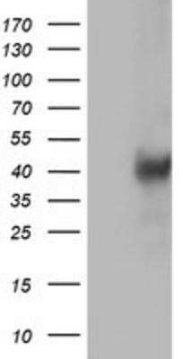 Western Blot: LCMT1 Antibody (OTI2C9) - Azide and BSA Free [NBP2-71927] - HEK293T cells were transfected with the pCMV6-ENTRY control (Left lane) or pCMV6-ENTRY LCMT1 (Right lane) cDNA for 48 hrs and lysed. Equivalent amounts of cell lysates (5 ug per lane) were separated by SDS-PAGE and immunoblotted with anti-LCMT1.