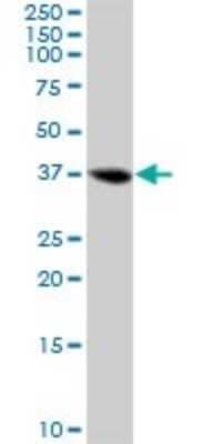 Western Blot: LCMT1 Antibody [H00051451-B01P] - Analysis of LCMT1 expression in human kidney.