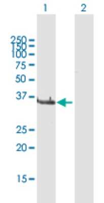 Western Blot: LCMT1 Antibody [H00051451-D01P] - Analysis of LCMT1 expression in transfected 293T cell line by LCMT1 polyclonal antibody.Lane 1: LCMT1 transfected lysate(38.40 KDa).Lane 2: Non-transfected lysate.