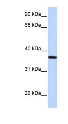 Western Blot: LCN12 Antibody [NBP1-58052] - Human Heart lysate, concentration 0.2-1 ug/ml.