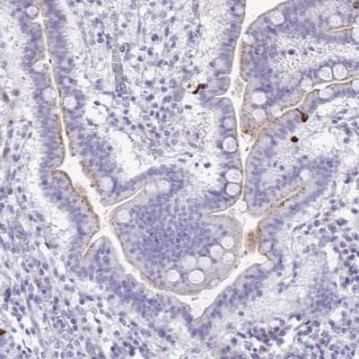 Immunohistochemistry-Paraffin: LCN15 Antibody [NBP2-32557] - Staining of human duodenum shows high expression.