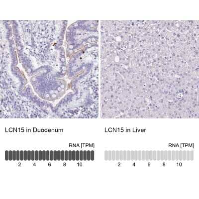 <b>Orthogonal Strategies Validation. </b>Immunohistochemistry-Paraffin: LCN15 Antibody [NBP2-32557] - Staining in human duodenum and liver tissues using anti-LCN15 antibody. Corresponding LCN15 RNA-seq data are presented for the same tissues.