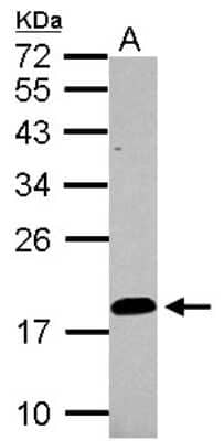 Western Blot: LCN15 Antibody [NBP2-15017] - Sample (30 ug of whole cell lysate) A: PC-3 12% SDS PAGE; antibody diluted at 1:1000.