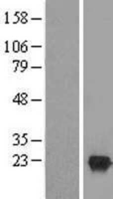 Western Blot: LCN15 Overexpression Lysate (Adult Normal) [NBL1-17623] Left-Empty vector transfected control cell lysate (HEK293 cell lysate); Right -Over-expression Lysate for LCN15.