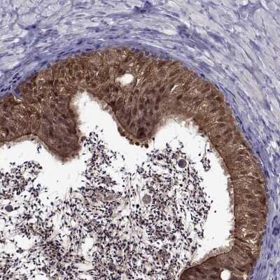 Immunocytochemistry/Immunofluorescence: LCN9 Antibody [NBP2-68766] - Immunohistochemical staining of human epididymis shows strong cytoplasmic and nuclear positivity in glandular cells.