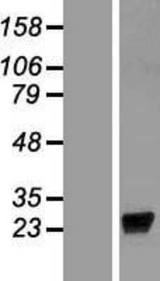 Western Blot: LCN9 Overexpression Lysate (Adult Normal) [NBP2-08949] Left-Empty vector transfected control cell lysate (HEK293 cell lysate); Right -Over-expression Lysate for LCN9.