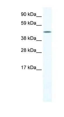 Western Blot: LCORL Antibody [NBP1-91618] - Human Testis lysate, concentration 1.25ug/ml.
