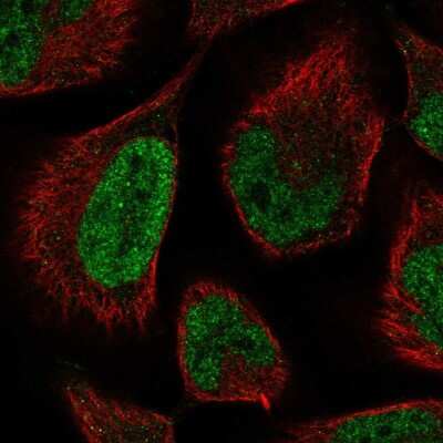 Immunocytochemistry/Immunofluorescence: LCoR Antibody [NBP2-57682] - Staining of human cell line RH-30 shows localization to nucleoplasm.