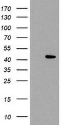 Western Blot: LDAH Antibody (OTI2G9) - Azide and BSA Free [NBP2-72122] - HEK293T cells were transfected with the pCMV6-ENTRY control (Left lane) or pCMV6-ENTRY C2orf43 (Right lane) cDNA for 48 hrs and lysed. Equivalent amounts of cell lysates (5 ug per lane) were separated by SDS-PAGE and immunoblotted with anti-C2orf43.