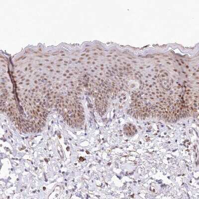 Immunohistochemistry-Paraffin: LDB1 Antibody [NBP1-85573] - Staining of human skin shows moderate nuclear positivity in squamous epithelial cells.