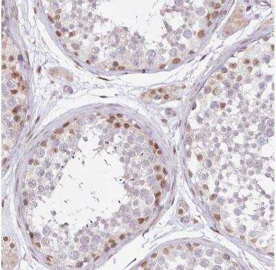 Immunohistochemistry-Paraffin: LDB1 Antibody [NBP1-85573] - Staining of human testis shows moderate nuclear positivity in a subset of cells in seminiferous ducts.