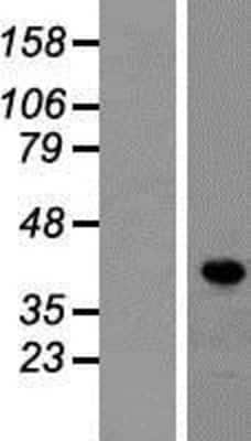 Western Blot: LDB1 Overexpression Lysate (Adult Normal) [NBP2-07940] Left-Empty vector transfected control cell lysate (HEK293 cell lysate); Right -Over-expression Lysate for LDB1.