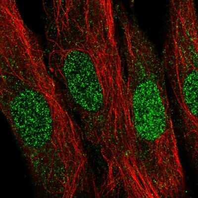 Immunocytochemistry/Immunofluorescence: LDB2 Antibody [NBP2-55705] - Staining of human cell line BJ shows localization to nucleus.