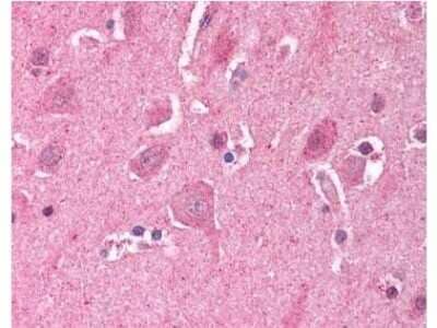 Immunohistochemistry: LDB2 Antibody [NB600-480] - Used at a 5 ug/ml to detect LDB2 in human brain cortex tissue. The image shows the localization of antibody as the precipitated red signal, with a hematoxylin purple nuclear counter stain. Tissue was formalin-fixed and paraffin embedded.