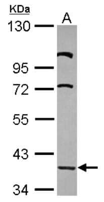 Western Blot: LDB2 Antibody [NBP2-19341] - Sample (30 ug of whole cell lysate) A: HeLa 10% SDS PAGE gel, diluted at 1:500.