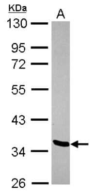 Western Blot: LDB2 Antibody [NBP2-19342] - Sample (30 ug of whole cell lysate) A: NT2D1 10% SDS PAGE gel, diluted at 1:500.