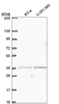 Western Blot: LDB2 Antibody [NBP2-55705] - Western blot analysis in human cell line RT-4 and human cell line U-251 MG.