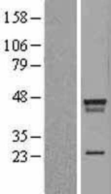 Western Blot: LDB2 Overexpression Lysate (Adult Normal) [NBL1-12469] Left-Empty vector transfected control cell lysate (HEK293 cell lysate); Right -Over-expression Lysate for LDB2.