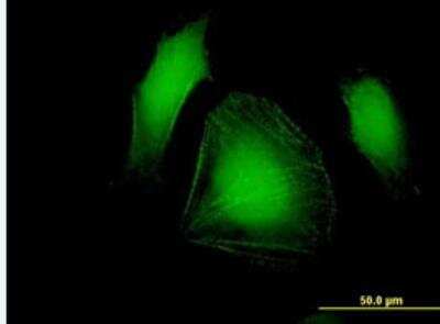 Immunocytochemistry/Immunofluorescence: LDB3 Antibody [H00011155-B01P-50ug] -  Purified MaxPab antibody to LDB3 on HeLa cell. [antibody concentration 10 ug/ml]