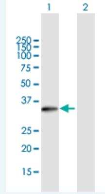 Western Blot: LDB3 Antibody [H00011155-B01P-50ug] - Analysis of LDB3 expression in transfected 293T cell line (H00011155-T01) by LDB3 MaxPab polyclonal antibody.   Lane 1: LDB3 transfected lysate(31.13 KDa). Lane 2: Non-transfected lysate.