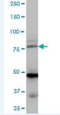 Western Blot: LDB3 Antibody [H00011155-B01P-50ug] - MaxPab polyclonal antibody. Western Blot analysis of LDB3 expression in human colon.