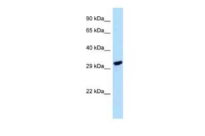 Western Blot: LDHAL6A Antibody [NBP2-84130] - WB Suggested Anti-LDHAL6A Antibody. Titration: 1.0 ug/ml. Positive Control: HepG2 Whole Cell