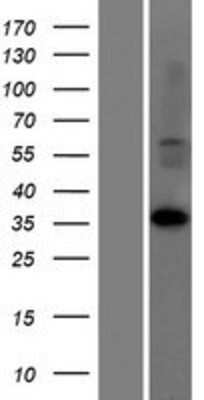 Western Blot: LDHAL6A Overexpression Lysate (Adult Normal) [NBP2-05520] Left-Empty vector transfected control cell lysate (HEK293 cell lysate); Right -Over-expression Lysate for LDHAL6A.