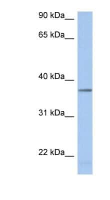 Western Blot: LDHAL6B Antibody [NBP1-55494] - Titration: 0.2-1 ug/ml, Positive Control: Human kidney.