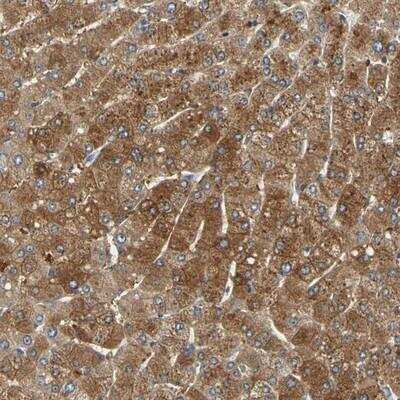 Immunohistochemistry-Paraffin: LDL R Antibody [NBP1-87476] - Staining of human liver shows strong cytoplasmic positivity in hepatocytes.