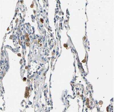 Immunohistochemistry-Paraffin: LDL R Antibody [NBP1-87476] - Staining of human lung shows strong cytoplasmic positivity in macrophages.