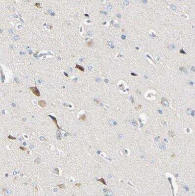 Immunohistochemistry-Paraffin: LDL R Antibody [NBP1-87476] - Staining of human cerebral cortex shows moderate cytoplasmic positivity in neurons.