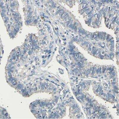 Immunohistochemistry-Paraffin: LDL R Antibody [NBP1-87476] - Staining of human fallopian tube shows no positivity in glandular cells as expected.