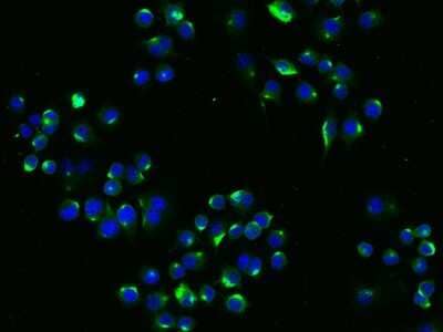 Immunocytochemistry/Immunofluorescence: LDLR Antibody (004) [NBP2-90522] - Immunofluorescence staining of mLDLR in RAW264.7 cells. Cells were fixed with 4% PFA, blocked with 10% serum, and incubated with rabbit anti-mouse mLDLR monoclonal antibody (dilution ratio 1:60) at 4C overnight. Then cells were stained with the Alexa Fluor(R)488-conjugated Goat Anti-rabbit IgG secondary antibody (green) and counterstained with DAPI (blue).Positive staining was localized to Cytoplasm .