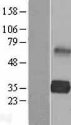 Western Blot: LDLRAD2 Overexpression Lysate (Adult Normal) [NBL1-12476] Left-Empty vector transfected control cell lysate (HEK293 cell lysate); Right -Over-expression Lysate for LDLRAD2.