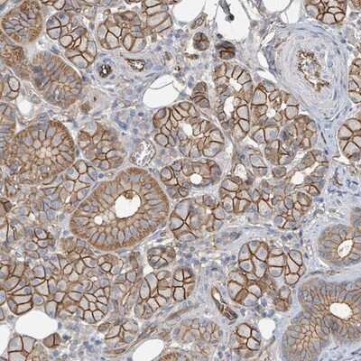 Immunohistochemistry-Paraffin: LDOC1 Antibody [NBP2-14191] - Staining of human salivary gland shows strong membranous positivity in glandular cells.