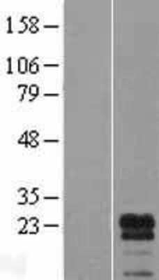 Western Blot LDOC1L Overexpression Lysate