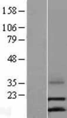 Western Blot: LEC Overexpression Lysate (Adult Normal) [NBL1-08846] Left-Empty vector transfected control cell lysate (HEK293 cell lysate); Right -Over-expression Lysate for LEC.