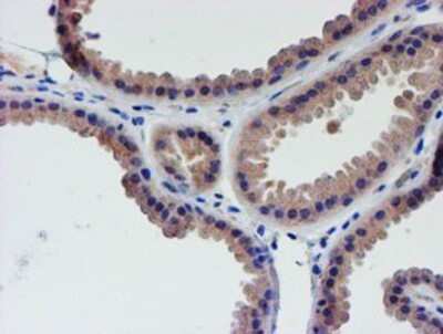 Immunohistochemistry: LECT2 Antibody (OTI2A11) - Azide and BSA Free [NBP2-71122] - Staining of paraffin-embedded Human breast tissue using anti-LECT2 mouse monoclonal antibody.