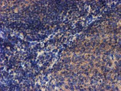 Immunohistochemistry: LECT2 Antibody (OTI2A11) - Azide and BSA Free [NBP2-71122] - Staining of paraffin-embedded Human tonsil using anti-LECT2 mouse monoclonal antibody.