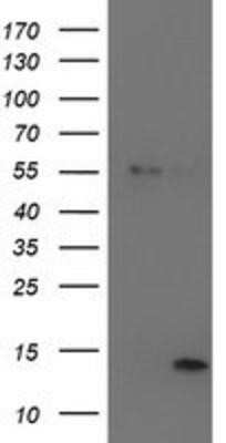 Western Blot: LECT2 Antibody (OTI2A11) - Azide and BSA Free [NBP2-71122] - HEK293T cells were transfected with the pCMV6-ENTRY control (Left lane) or pCMV6-ENTRY LECT2 (Right lane) cDNA for 48 hrs and lysed. Equivalent amounts of cell lysates (5 ug per lane) were separated by SDS-PAGE and immunoblotted with anti-LECT2.