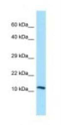 Western Blot: LECT2 Antibody [NBP1-98454] - HepG2 Cell Lysate 1.0ug/ml, Gel Concentration: 10-20%