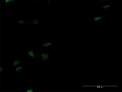 Immunocytochemistry/Immunofluorescence: LEF1 Antibody (1A8) [H00051176-M06] - Analysis of monoclonal antibody to LEF1 on HeLa cell. Antibody concentration 10 ug/ml