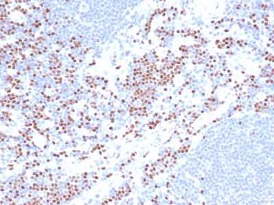 Immunohistochemistry-Paraffin: LEF1 Antibody (LEF1/422R) - Azide and BSA Free [NBP3-08519] - Formalin-fixed, paraffin-embedded analysis of human lymph node. Nuclear staining of non-germinal center cells using LEF1 antibody (LEF1/422R) at 2ug/ml in PBS for 30min RT. HIER: Tris/EDTA, pH9.0, 45min. 2 : HRP-polymer, 30min. DAB, 5min.