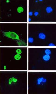 Immunocytochemistry/Immunofluorescence: LEF1 Antibody (REMB6) [NBP2-66626] - Immunofluorescence staining of Cos-1 cells transfected with (top to bottom) full length hLEF-1, a LEF-1 mutant missing the nuclear localization signal, TCF-4 and TCF-1. Cells were stained with Novus' LEF-1 antibody, clone REMB6 cat. # NBP2-66626 and visualized with FITC conjugated mouse IgG. DAPI was used to detect all nuclei. The LEF/TCF/HMG, clone REMB6 recognizes an epitope in the highly conserved HMG DNA binding domain.