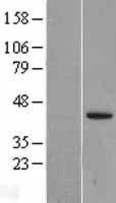 Western Blot: Lefty-2 Overexpression Lysate (Native) [NBL1-12485] - Left-Empty vector transfected control cell lysate (HEK293 cell lysate); Right -Over-expression Lysate for LEFTY2.