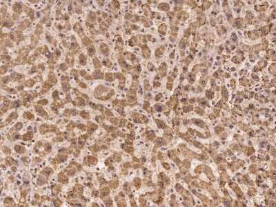 Immunohistochemistry-Paraffin: LEKR1 Antibody [NBP3-06248] - Immunochemical staining of human LEKR1 in human liver with rabbit polyclonal antibody at 1:100 dilution, formalin-fixed paraffin embedded sections.