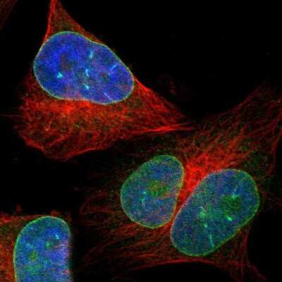 Immunocytochemistry/ Immunofluorescence LEMD2 Antibody - BSA Free